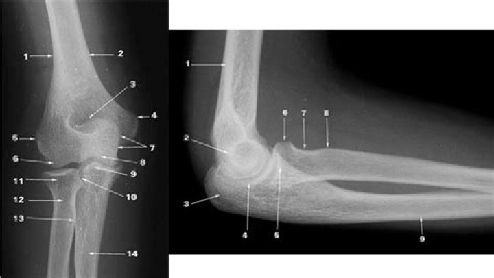 Elbow labeling 2 x ray Quiz