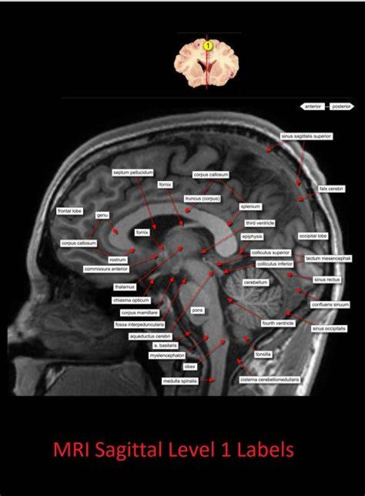 MRI Brain Anatomy Quiz
