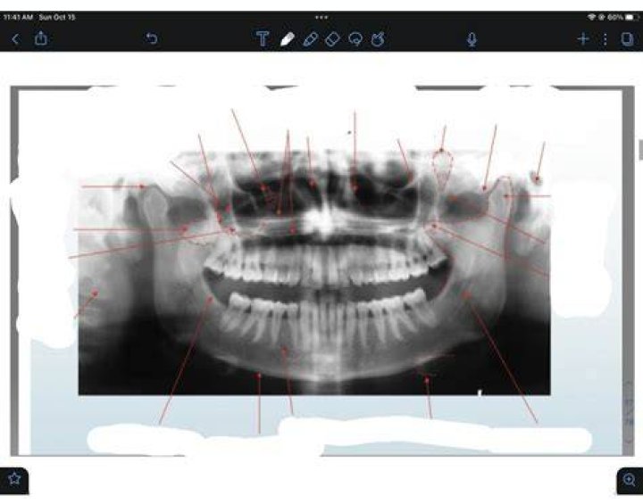 Pano Anatomy Quiz